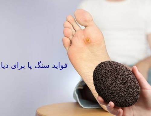 فواید سنگ پا برای دیابت و بهبود آن